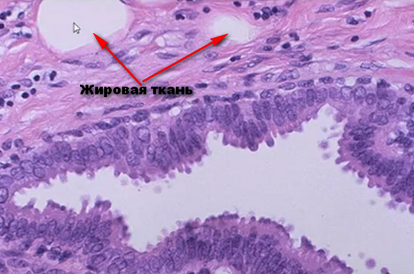 микроскопия молочной железы