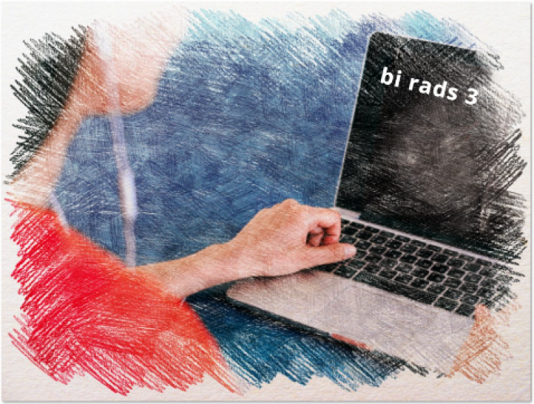 Маммография bi rads 3